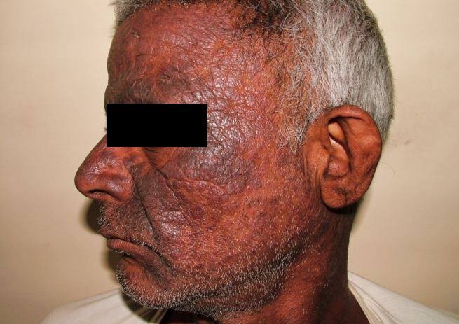 Vimla Skin Clinic